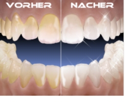 Vergleich: vorher - nachher 