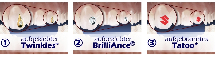 Beispiele für Zahnschmuck